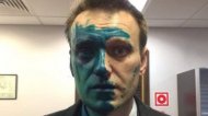 Навальный обвинил Кремль в причастности к нападению на него