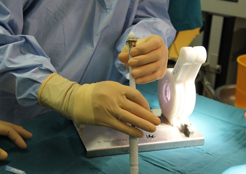 КРАСНОДАР. Кубанские хирурги провели уникальную операцию на сердце