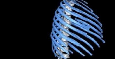 Ученые реконструировали грудную клетку неандертальца