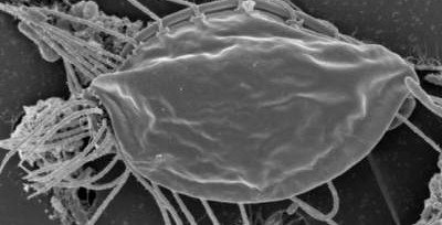 В Канаде студентка случайно нашла неизвестные ранее микроорганизмы