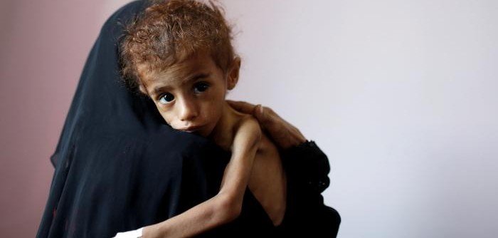 ООН: В Йемене из-за войны каждый 10 минут умирает ребенок