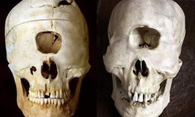 Археологи нашли череп настоящего циклопа