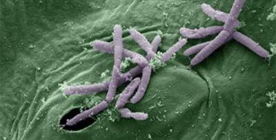 В случае опасности для жизни бактерии переходят в «режим зомби»