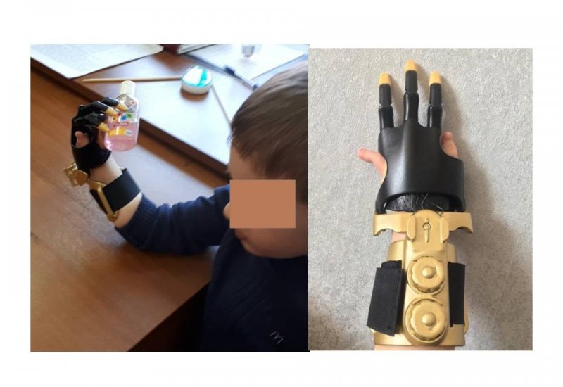СЕВЕРНАЯ ОСЕТИЯ. 4-летнему мальчику из Алагира в Сколково изготовили протез кисти руки