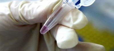 Ученые испытали новую вакцину против рака