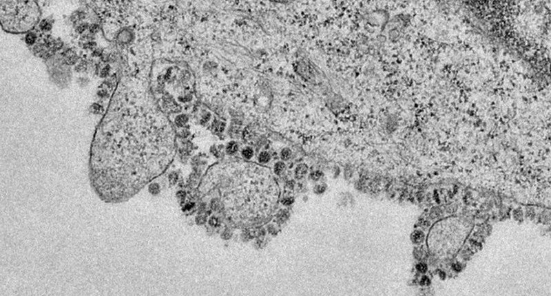 Ученые показали, как размножается коронавирус