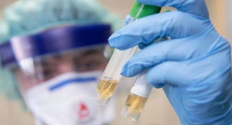 В Австралии ученые нашли препарат, быстро подавляющий коронавирус