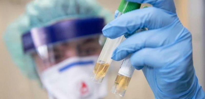 ЧЕЧНЯ. В ЧР за сутки зафиксировано девять новых случаев коронавируса
