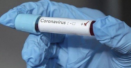 КБР. В КБР за сутки исследовано 1110 тестов на коронавирус