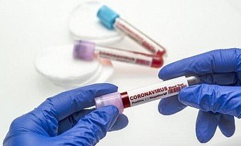 РОСТОВ. В Ростовской области за вчерашний день выявили еще 129 зараженных коронавирусом жителей