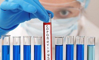 РОСТОВ. В Ростовской области зарегистрировано 128 новых случаев коронавируса