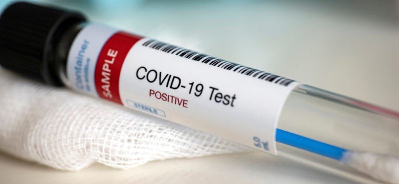ЧЕЧНЯ. С начала пандемии по 28 сентября 2020 года в ЧР сделано 280 884 теста на COVID-19