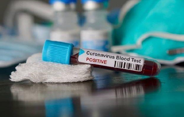 ЕС и ВОЗ передали минздраву Армении тесты на COVID-19 и медоборудование