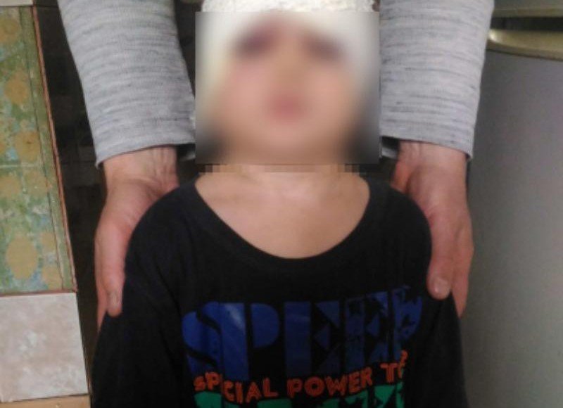 ВОЛГОГРАД. В Волжском пьяный отчим избил трехлетнего малыша до гематом и травм головы
