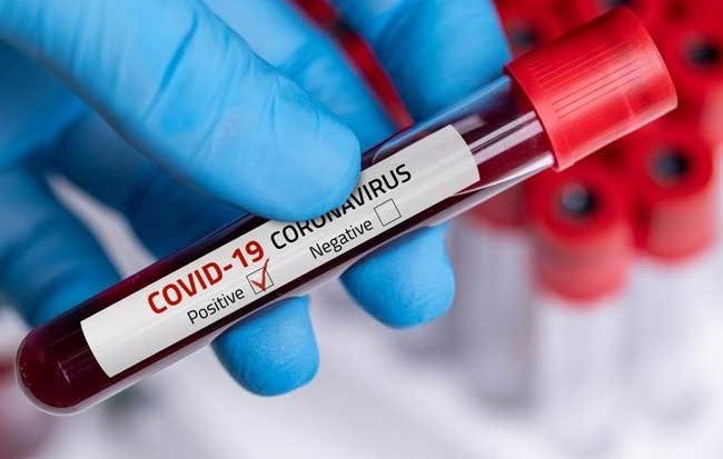 ИНГУШЕТИЯ. Более 500 человек заболевших Covid-19 в Ингушетии — дети до 14 лет
