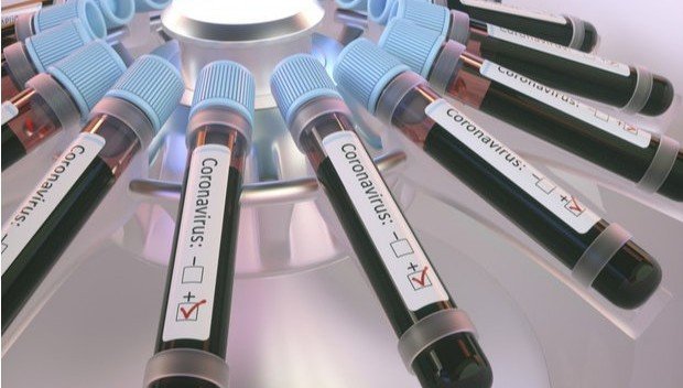 ИНГУШЕТИЯ. Число умерших от Covid-19 в Ингушетии возросло до 140 человек