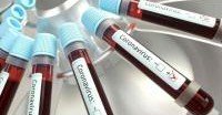 ИНГУШЕТИЯ. В Ингушетии за сутки коронавирус выявлен у 56 человек