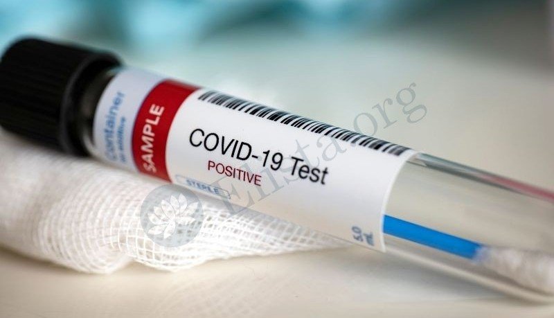 КАЛМЫКИЯ. В Калмыкии за сутки выявлено 76 новых случаев инфицирования COVID-19