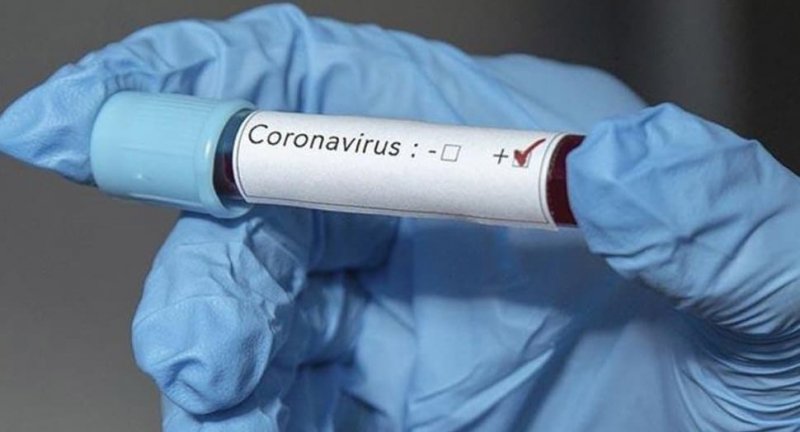 КБР. Оперативный штаб в КБР напоминает о необходимости соблюдать меры профилактики от коронавируса