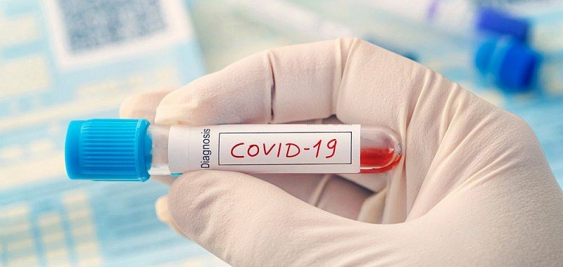 КРАСНОДАР. На Кубани выявили 157 новых случаев COVID-19