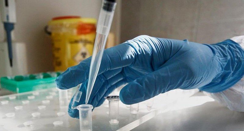 В США создали тест, способный искать коронавирус на клеточном уровне