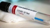 ИНГУШЕТИЯ. В Ингушетии за сутки Covid-19 подтвержден у 11 человек