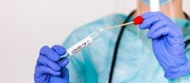 ЧЕЧНЯ. В Чеченской Республике за сутки выявили 9 случаев коронавируса
