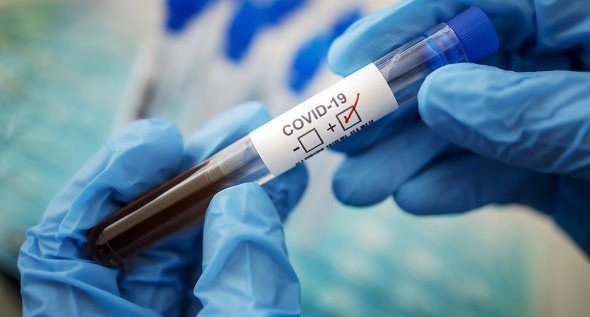 ЧЕЧНЯ. В Чеченской Республике за сутки выявили 127 случаев коронавируса