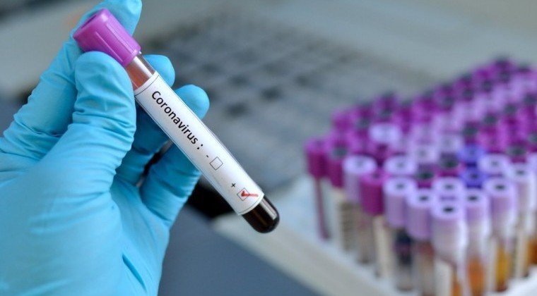 ЧЕЧНЯ. В Чеченской Республике за сутки выявили 73 случая коронавируса