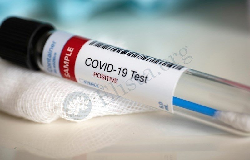 КАЛМЫКИЯ. В Калмыкии число заразившихся COVID-19 за сутки составило 118 случаев
