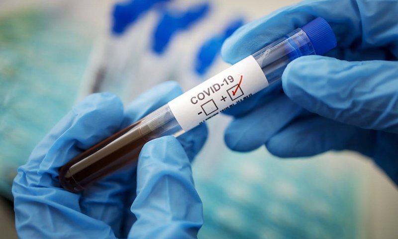 КРАСНОДАР. На Кубани выявлено рекордное количество заболевших коронавирусом