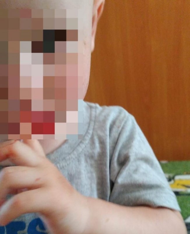 СТАВРОПОЛЬЕ. Мальчика избили в частном детском саду в Ставрополе
