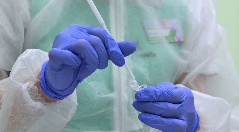 ЧЕЧНЯ. За сутки в Чеченской Республике выявили 172 случая коронавируса