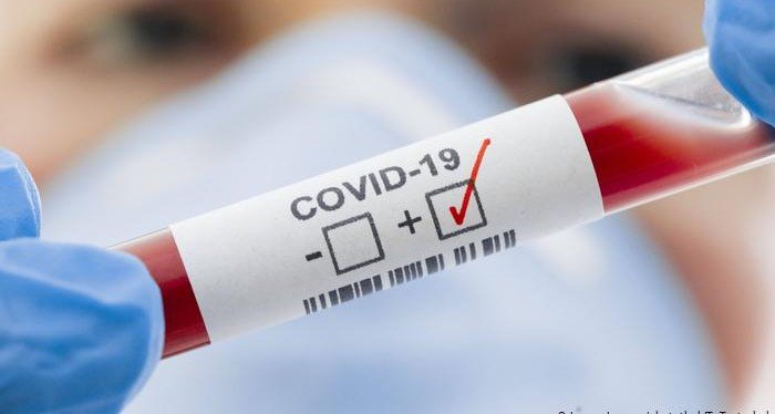ЧЕЧНЯ. В ЧР с начала июля впервые зарегистрировано менее 70 случаев заражения COVID-19