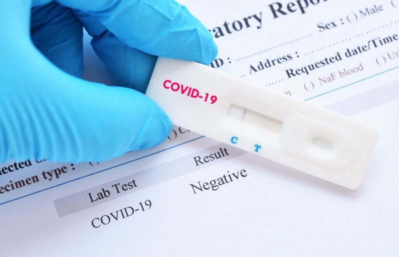 С. ОСЕТИЯ. В республику поступили экспресс-тесты для выявления COVID-19