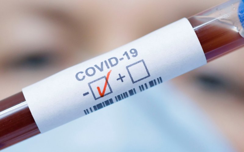 ЧЕЧНЯ. За сутки в ЧР выявлено 113 новых случаев COVID-19