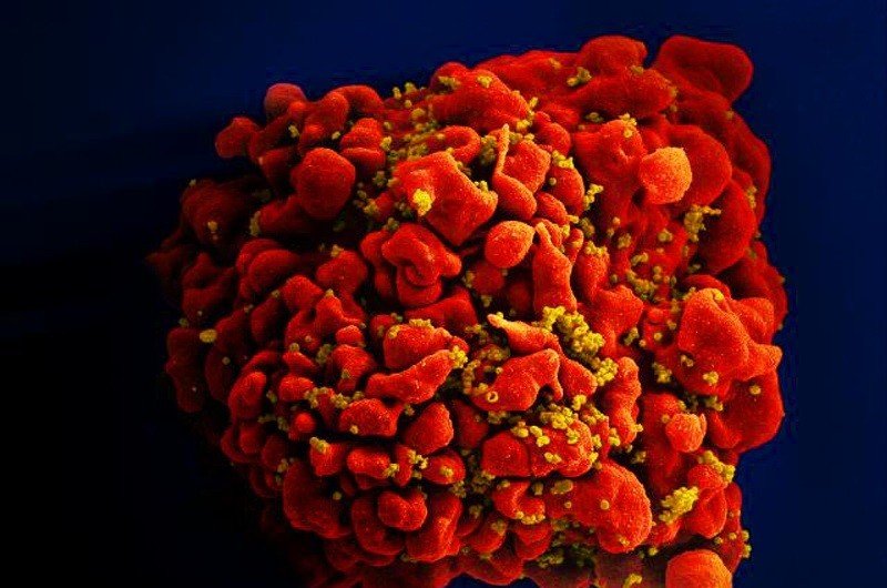 Предложен новый подход к лечению ВИЧ