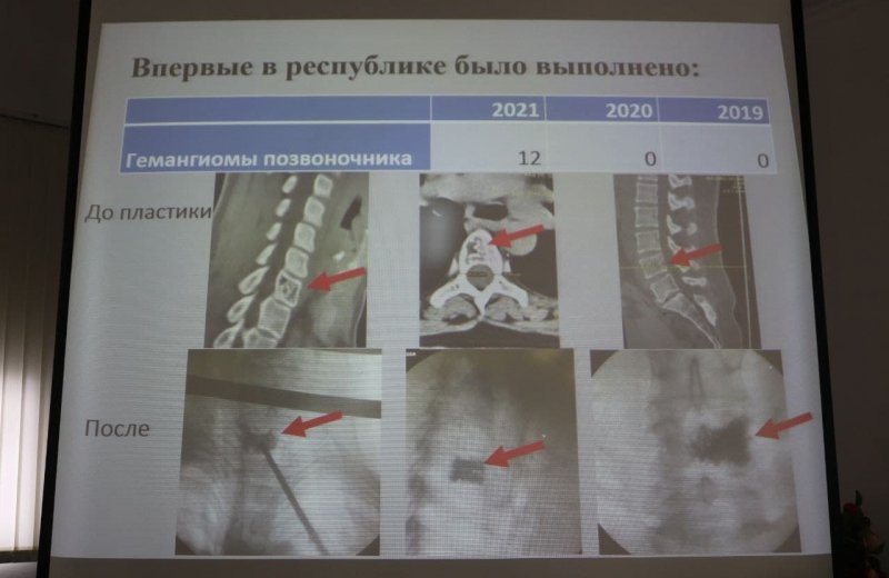 ЧЕЧНЯ. В РКБ им. Ш. Ш. Эпендиева проведено свыше 370 успешных операций в области нейрохирургии