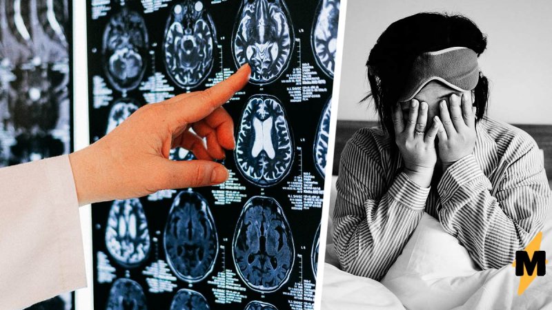 Французские медики научились измерять уровень креативности по томографии мозга