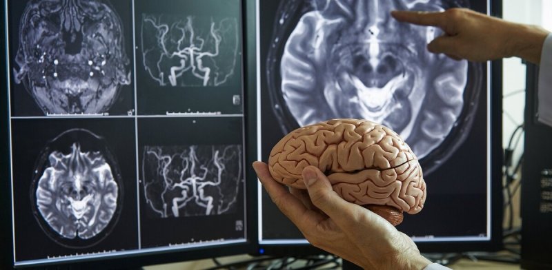 Медики назвали три привычки против старения мозга